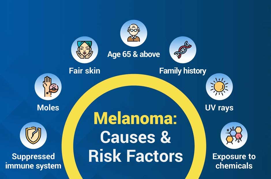 Melanoma Skin Cancer 