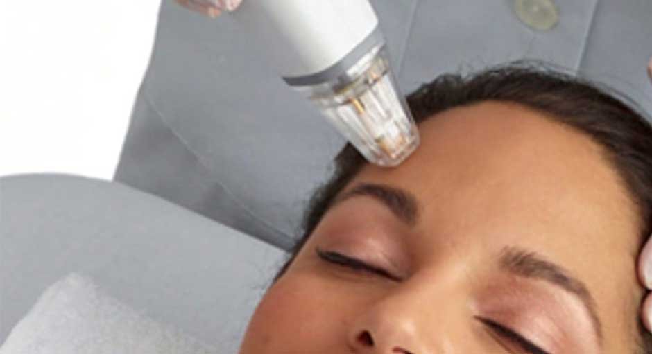 Potenza Rf Microneedling A Non Invasive Solution For Skin Rejuvenation