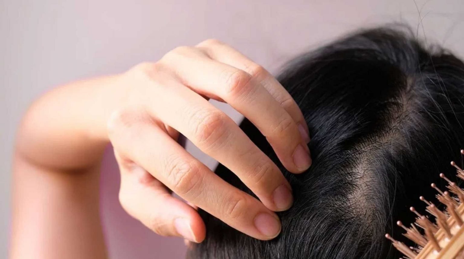 Top Ingredients in Your Shampoo That Can Cause Hair Loss Cause Hair Loss